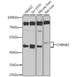 CHRNB2 Rabbit pAb