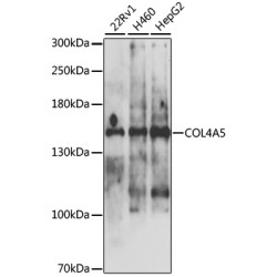 COL4A5 Rabbit pAb