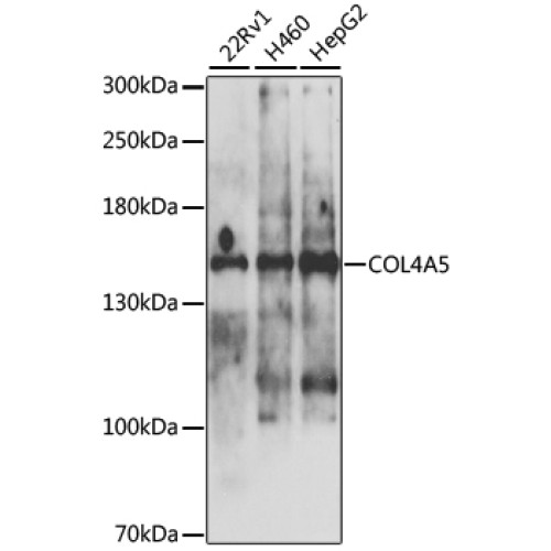 COL4A5 Rabbit pAb