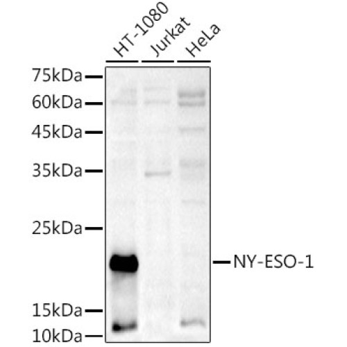 NY-ESO-1 Rabbit pAb
