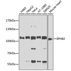 EPHB2 Rabbit pAb
