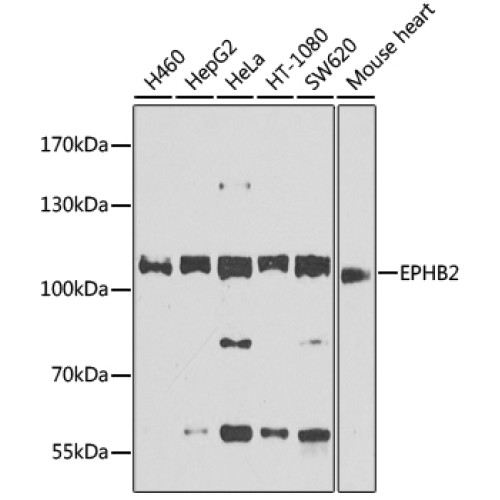EPHB2 Rabbit pAb