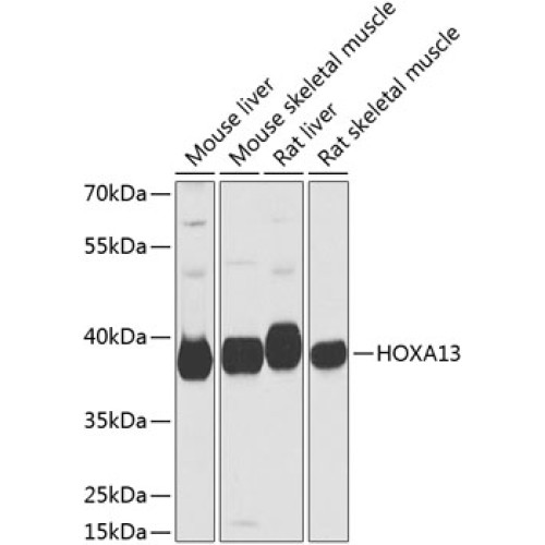 HOXA13 Rabbit pAb