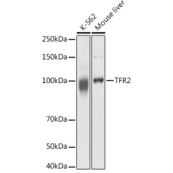 TFR2 Rabbit pAb