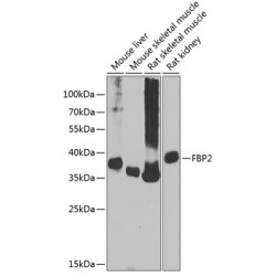 FBP2 Rabbit pAb