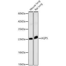 AQP5 Rabbit pAb