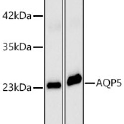 AQP5 Rabbit pAb