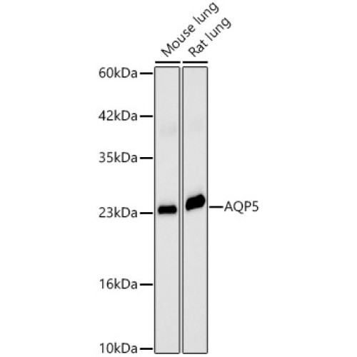 AQP5 Rabbit pAb