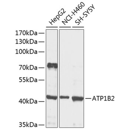 ATP1B2 Rabbit pAb