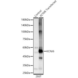 KCNJ6 Rabbit pAb