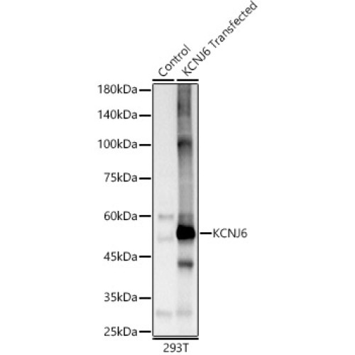 KCNJ6 Rabbit pAb
