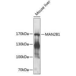 MAN2B1 Rabbit pAb