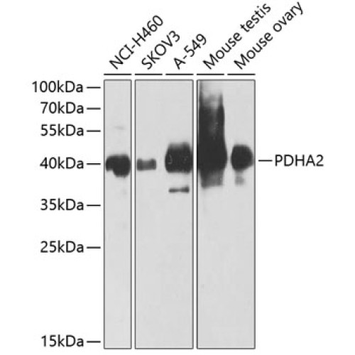PDHA2 Rabbit pAb