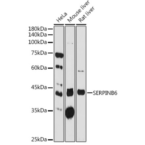 SERPINB6 Rabbit pAb