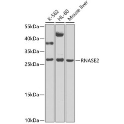 RNASE2 Rabbit pAb
