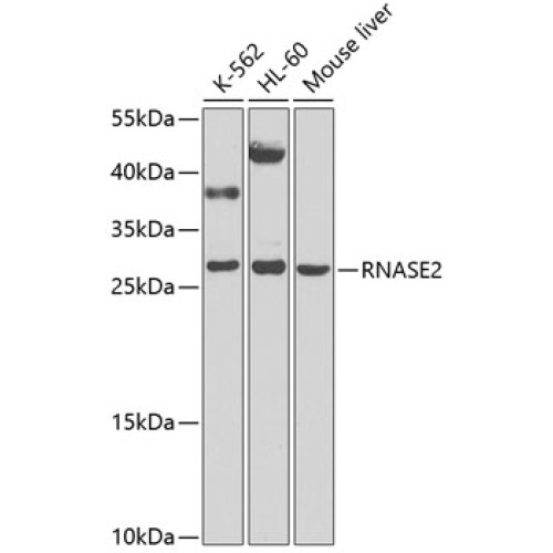 RNASE2 Rabbit pAb