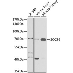 SOCS6 Rabbit pAb
