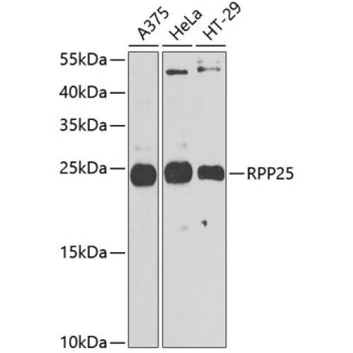 RPP25 Rabbit pAb