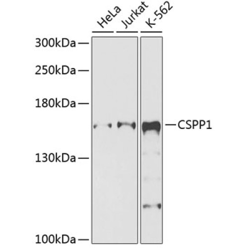 CSPP1 Rabbit pAb