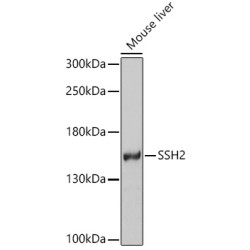 SSH2 Rabbit pAb