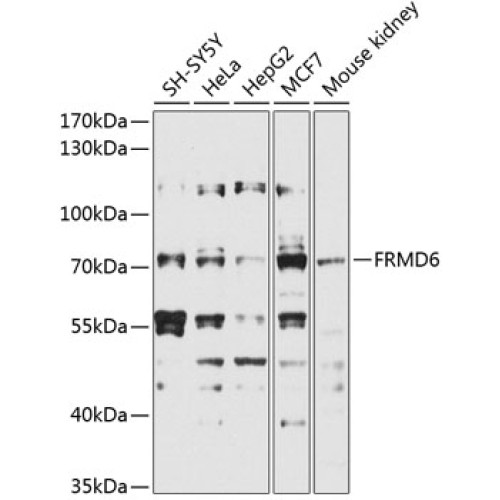 FRMD6 Rabbit pAb
