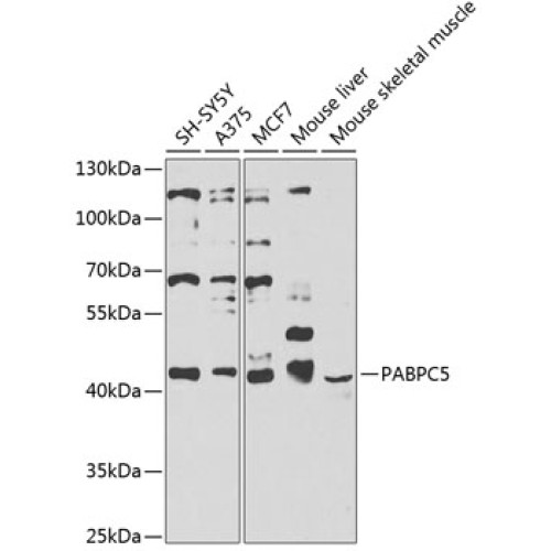 PABPC5 Rabbit pAb