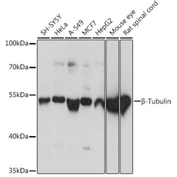 β-Tubulin Rabbit pAb