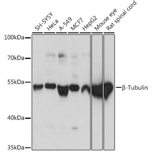 β-Tubulin Rabbit pAb