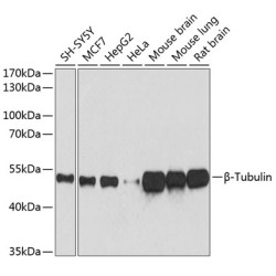 β-Tubulin Mouse mAb