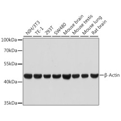 β-Actin Rabbit mAb (High Dilution)