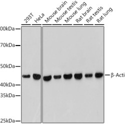 β-Actin Rabbit mAb