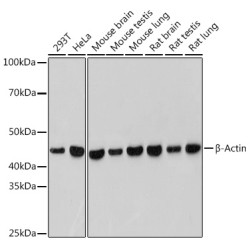 β-Actin Rabbit mAb