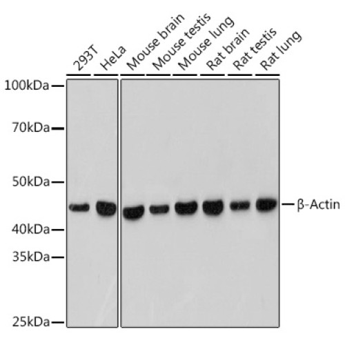 β-Actin Rabbit mAb