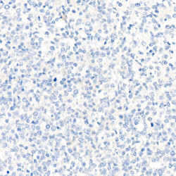 Rabbit IgG isotype control
