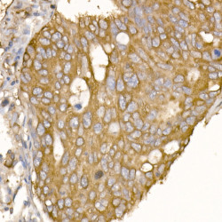 α-Tubulin Rabbit mAb