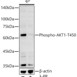 Phospho-AKT1-T450 Rabbit pAb