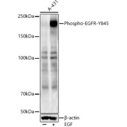 Phospho-EGFR-Y845 Rabbit pAb