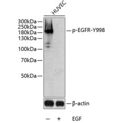 Phospho-EGFR-Y998 Rabbit pAb