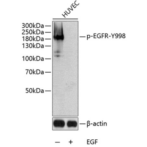 Phospho-EGFR-Y998 Rabbit pAb