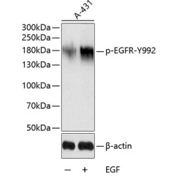 Phospho-EGFR-Y992 Rabbit pAb