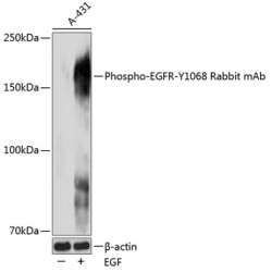 Phospho-EGFR-Y1068 Rabbit mAb