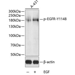 Phospho-EGFR-Y1148 Rabbit pAb