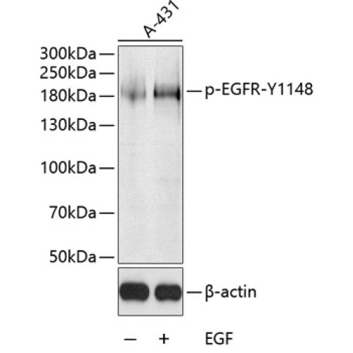 Phospho-EGFR-Y1148 Rabbit pAb