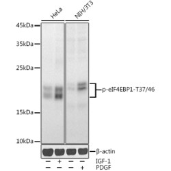 Phospho-eIF4EBP1-T37/46 Rabbit pAb