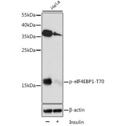 Phospho-eIF4EBP1-T70 Rabbit pAb