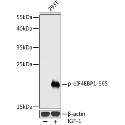 Phospho-eIF4EBP1-S65 Rabbit pAb