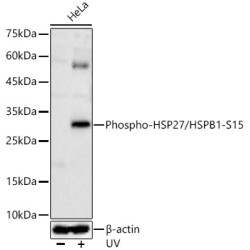Phospho-HSP27/HSPB1-S15 Rabbit pAb