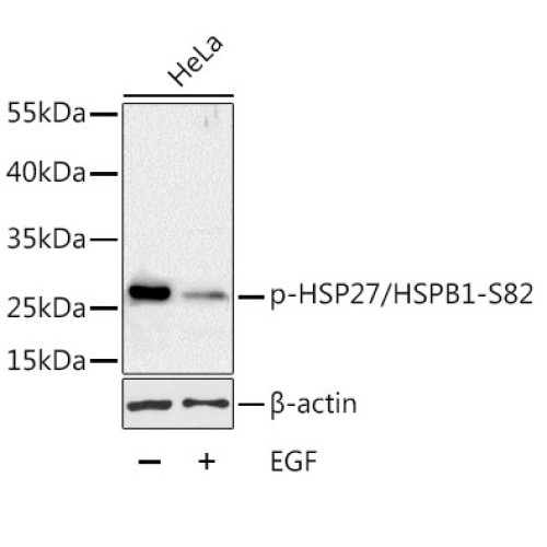 Phospho-HSP27/HSPB1-S82 Rabbit pAb