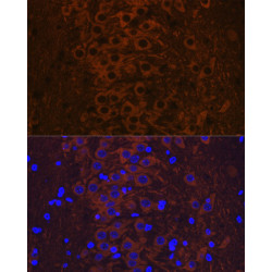 Phospho-Tau-T231 Rabbit mAb