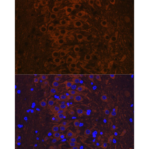 Phospho-Tau-T231 Rabbit mAb